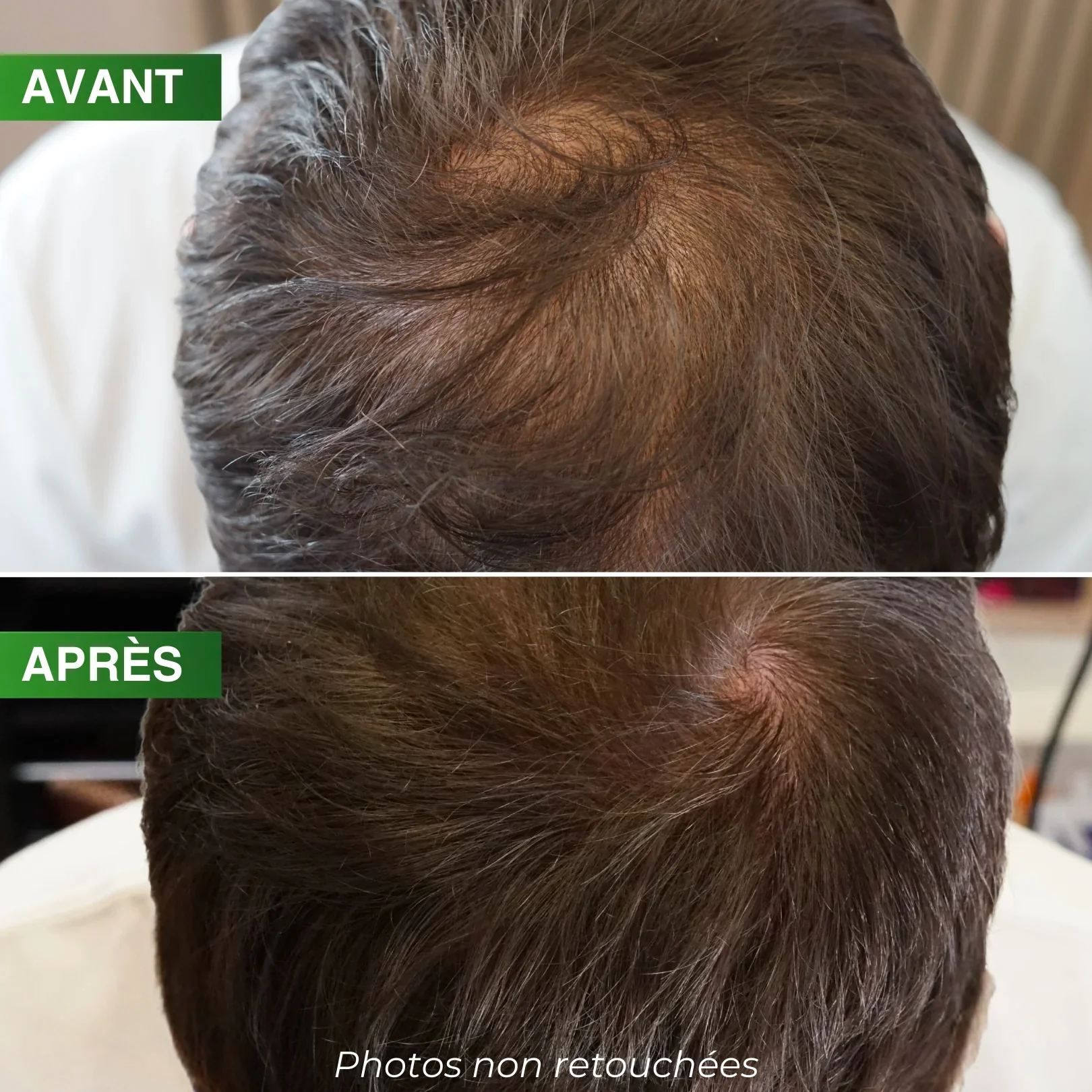 Shampoing Énergisant Densité Pro BBHAIR Generik 250 ML - Image 3